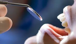 treatment if gingivitis, parodontology, periodontal procedures, Hungary Csopak,